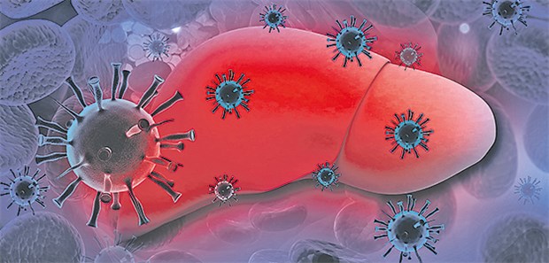 HCV-Infektion: Acht extrahepatische Manifestationen nahmen Forscher unter die Lupe.