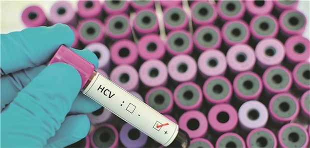 "Trend zu acht Wochen HCV-Therapie" HCV-positiv: Die Heilungsraten bei therapienaiven, nichtzirrhotischen Patienten liegen inzwischen über 98 Prozent.