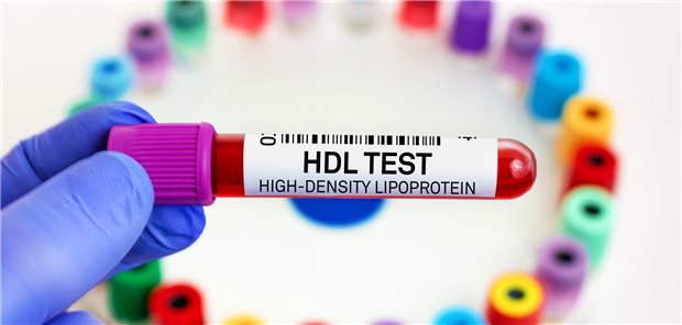 HDL-C-Check: Ein niedriges HDL-C war bei weißen Teilnehmern einer US-Studie zwar mit einem erhöhten KHK-Risiko assoziiert. Ein hoher Wert bedeutete jedoch keinen Schutz.
