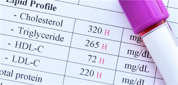 Abnorm hohe Lipidwerte in der Blutprobe eines Patienten.