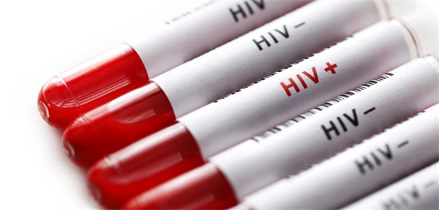 HIV-Proben: Die Dreimonatsspritze zur Verhütung von Schwangerschaften erhöht nicht das Risiko, sich mit HIV zu infizieren, ergab eine Studie.