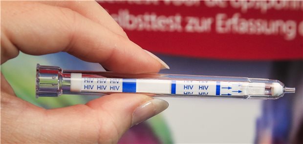 Wenn HIV-Selbsttests falsch anschlagen HIV-Selbsttests sind seit Oktober in Apotheken frei erhältlich.