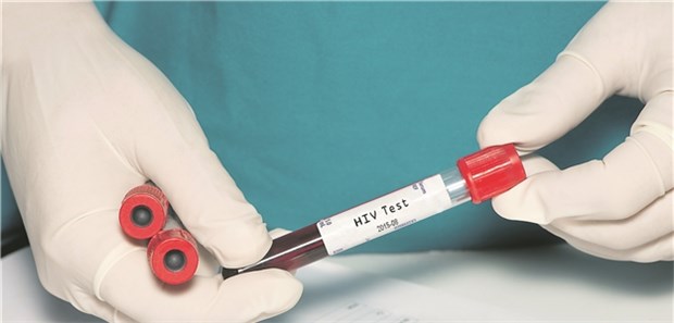 HIV-Test: Der Durchbruch wäre, bei bereits HIV-Infizierten eine bleibende Viruskontrolle ohne notwendige Dauertherapie zu erreichen.