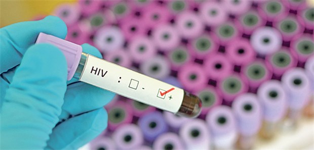 HIV-Infektion wird oft zu spät diagnostiziert HIV-Test: Viele Patienten verschweigen ihrem Arzt risikoreiches Sexualverhalten oder Drogengebrauch.