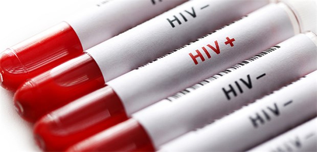 Weniger HIV-Neuinfektionen in Deutschland HIV-positiv: Rund 2.700 Bundesbürger haben sich im vergangenen Jahr neu mit dem HI-Virus angesteckt, schätzt das RKI.