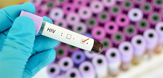 Hoffen auf die Therapie für alle HIV positiv - bei rund 3200 Menschen in Deutschland wird das jährlich neu festgestellt.