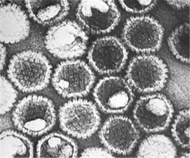 Virustatika oft nutzlos? HSV unter dem Elektronenmikroskop: Nur selten werden die Viren bei einer Enzephalitis nachgewiesen.