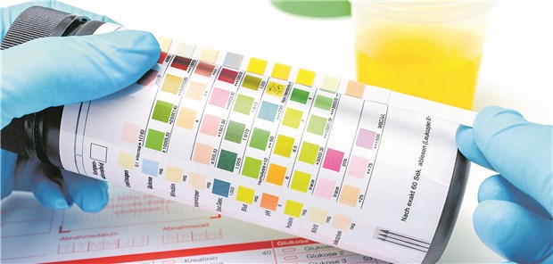 HWI? Bei dauerhafter Antibiotikaprophylaxe erhöhte sich in einer Studie die Resistenzrate.