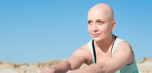 Weniger Chemotherapie bei Hodgkin-Lymphom nötig Haarausfall gehört zu den häufigen Nebenwirkungen einer Chemotherapie bei Patienten mit Hodgkin Lymphom.