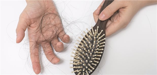 Haarausfall in Form von Alopecia areata ist wohl eine von mehreren unerwünschten Nebenwirkungen bei Patientinnen und Patienten, die mit Dupilumab behandelt werden.