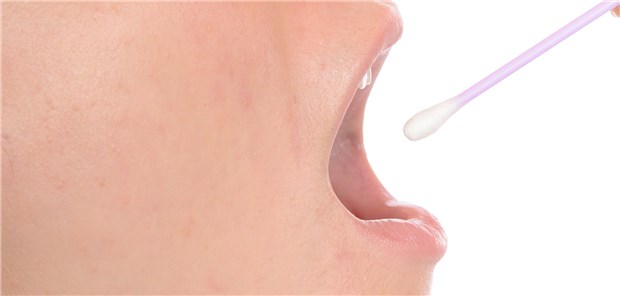 Haben Patienten erst seit zwei Tagen Symptome einer SARS-CoV-Infektion, dann ist ein Nasen- oder Rachen-Abstrich geeignet“, so der Virologe Dr. Victor Corman.