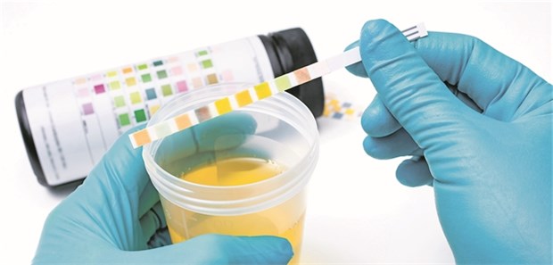 Benigne Krankheiten verzögern die Krebsdiagnose bei Hämaturie Hämaturie? Wie schnell bei diesem Befund Krebs diagnostiziert wird, hängt auch vom Arzt ab.
