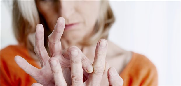 Hätte die rechtzeitige Prävention dies verhindern können? Europas Rheumatologen gehen hart mit der EU-Kommission ins Gericht, wenn es um die Umsetzung der Gesundheitsziele der Agenda 2030 geht.