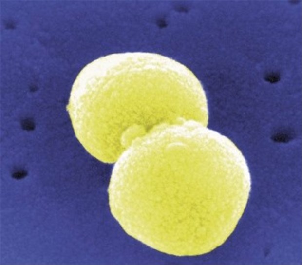 Pneumokokken-Impfung bei Influenza-Pandemie! Häufigster Erreger von Pneumonien: Streptococcus pneumoniae.