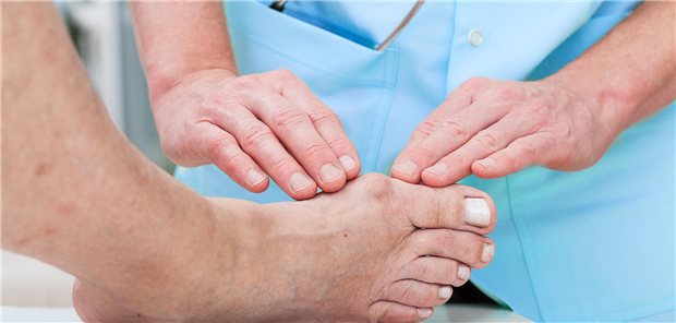 Orthopäde bei der Arbeit: Kontrolle des Fußes eines Patienten mit einer Hallux-valgus-Deformität.