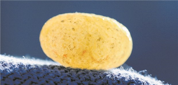 Harnleiterstein: Verzichtet man auf die medikamentöse Expulsionstherapie, steigt die Zahl chirurgischer Interventionen einer Studie zufolge nicht an.