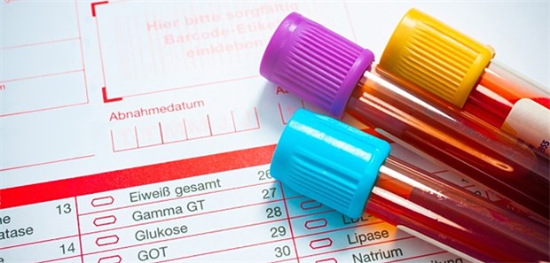 Hat das Labor Schottdorf bei der Abrechnung von Laborleistungen betrogen? Diese Frage klärt das Landgericht Augsburg.