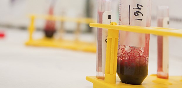 So verliert die Biopsie ihren Schrecken Hat's wehgetan?