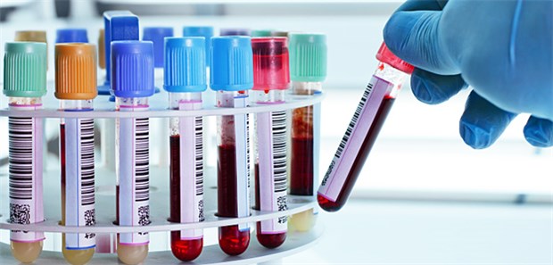 Hausärzte sind die Netto-Gewinner der Laborrefom.