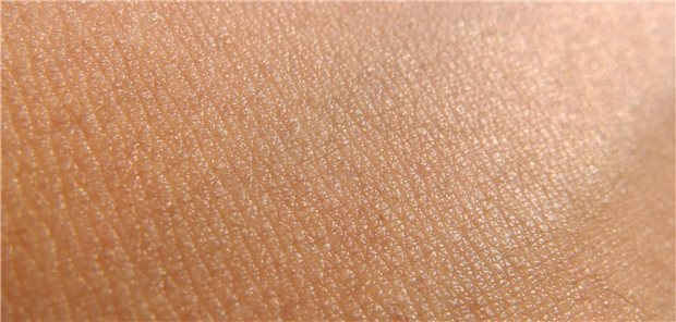 Parkinson: Hautbiopsien könnten sich als Zusatzdiagnostik bei REM-Störungen eignen Haut im Blick: Bei Patienten mit hohem Parkinsonrisiko geben Hautbiopsien Klarheit über den Verlauf.