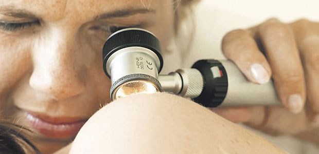 Weniger Melanom-Tote durch Screening Hautkrebsscreening lohnt sich - wie Daten einer Erhebung aus Schleswig-Holstein belegen.