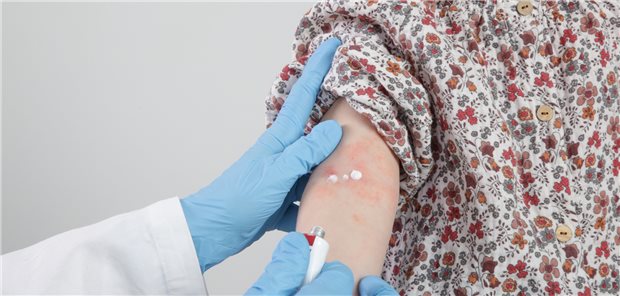 Hautpflege: Zusammen mit dem Vermeiden von Triggerfaktoren und Schulungen eine wichtige Basismaßnahme bei atopischer Dermatitis.