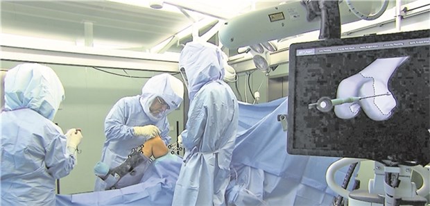 Präzise Knie-Op auf den Millimeter genau Hautschnitt: Professor Christian Hendrich (Mitte) und sein Team bei der Implantation einer unikondylären Schlittenprothese. Über Infrarot-Marker am Bein erfasst ein Computer die Position des Knies im Raum.