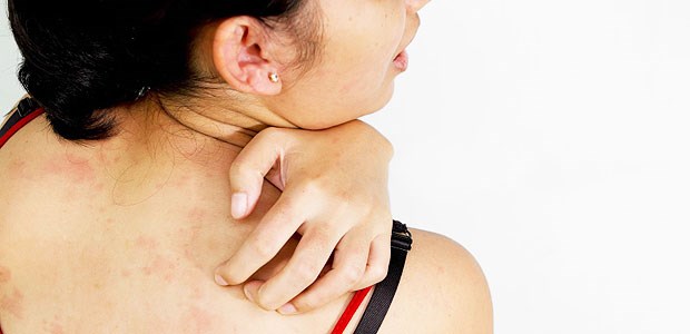 Heftiger Juckreiz während der Schwangerschaft: Steckt eine Lebererkrankung dahinter?