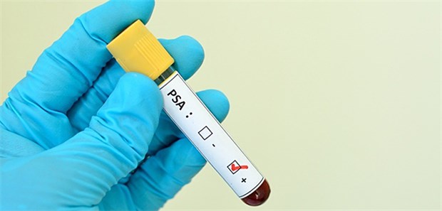 PSA erhöht, Biopsie negativ: Was tun? Helfen weitere Untersuchungen bei erhöhtem PSA-Wert und negativer Biopsie.