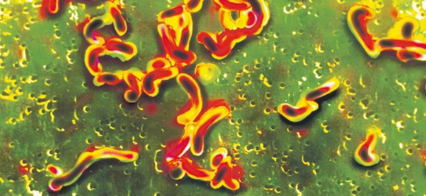 Helicobacter pylori im Rasterelektronenmikroskop; bis zu 40 Prozent der Infizierten hilft die herkömmliche Tripeltherapie nicht.