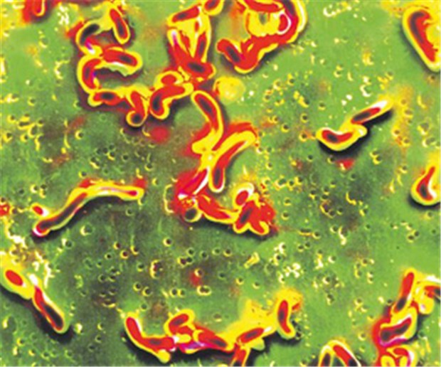H. pylori bei Sodbrennen rauswerfen Heliobacter pylori im Rasterelektronenmikroskop: Das Bakterium gehört zu den Hauptverursachern der funktionellen Dyspepsie.