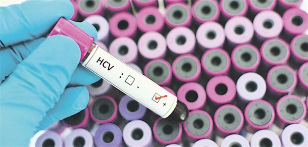 Vertrag nimmt Regressdruck von Ärzten Hepatitis C - diese Diagnose zieht teure Behandlungen nach sich.