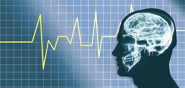So will man im Norden die Versorgung bei Schlaganfall verbessern Herausforderung Schlaganfall: Im Norden werden neue Versorgungsstrukturen entwickelt.