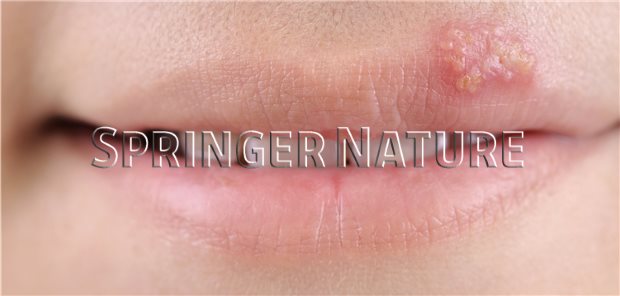 Aciclovir herpes tabletten