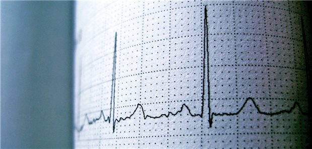 Herz-Rhythmus: Die Rhythmus-erhaltende Therapie punktet bei Patienten mit Vorhofflimmern und Herzinsuffizienz.