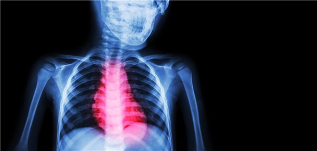 Herz im Blick: Spanische Mediziner haben untersucht, welche Therapie bei gebrechlichen Patienten mit NSTEMI effektiver ist.