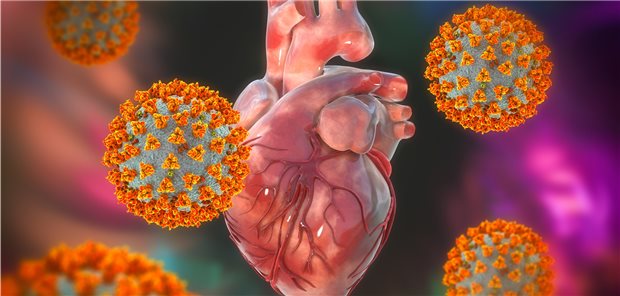 Herz im Fokus bei Corona: Bei hospitalisierten COVID-19-Patienten lassen sich offenbar recht häufig Perikardergüsse im Echo nachweisen, eine akute Perikarditis liegt jedoch selten vor.