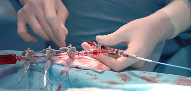 Kardiologie unter Druck Herzkatheter: Kardiologen spüren den Spardruck an den Kliniken und die Folgen des DRG-Systems.