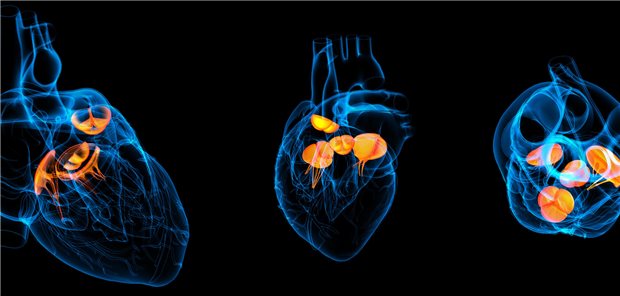 Herzklappen (orange) aus verschiedenen Perspektiven: Bei mechanischem Herzklappenersatz haben sich NOAK zur Antikoagulation nicht bewährt.