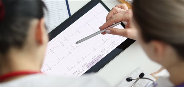 Herzrhythmusstörungen im EKG – wann wird es lebensbedrohlich?