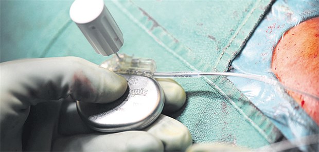 Viel Licht und etwas Schatten Herzschrittmacher vor der Implantation. OP-Revisionen weisen auf Mängel hin.