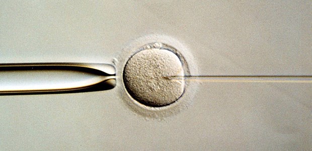 Wird die IvF zu leichtfertig eingesetzt? Heute ist das längst Standard: die künstliche Befruchtung einer Eizelle.
