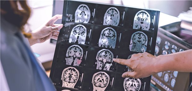 Hirnatrophie im MRT eines Demenzpatienten.