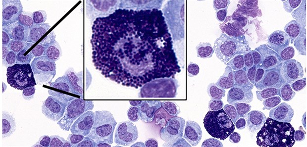 Histochemische Färbung von Leukozyten und stark granulierten Mastzellen |