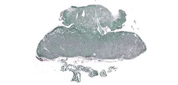 Histologisches Bild einer Rattenplazenta: Forscher analysierten mit Hilfe dieses Bildes unter anderem die Spiralarterien, um Rückschlüsse auf die Versorgung des Fetus zu gewinnen.