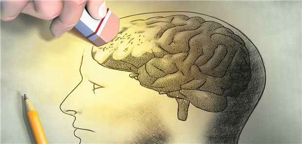 Demenz ist Haupttodesursache bei Down-Syndrom Hohe Demenzrate bei Down-Syndrom: Ist eine erhöhte Beta-Amyloid-Produktion der Grund?