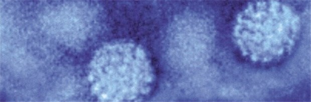 HPV-Impfung: Zwischen der Hoffnung auf Krebsschutz und der Sorge um die Gesundheit Humane Papilloma-Viren im Elektronenmikroskop: Vor allem die HPV-Typen 16 und 18 können Zervixkarzinome verursachen.