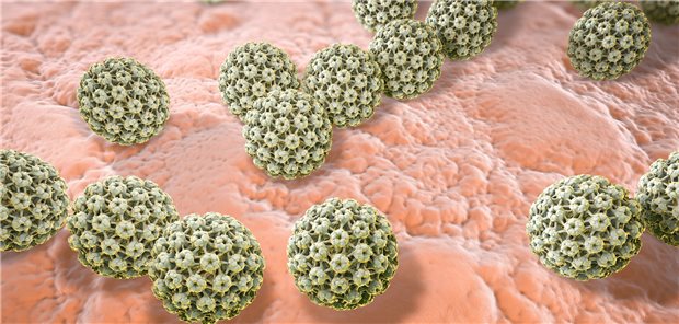 Humane Papillomaviren (HPV) verursachen nicht nur Geschlechtskrankheiten oder Warzen. Eine HPV-Infektion kann auch zu einer Krebserkrankung – z.B. im Kopf-Hals-Bereich – führen.&#xA;