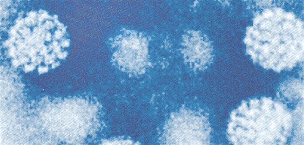 HPV auch bei Männern weit verbreitet Humane Papillomaviren (elektronenmikroskopische Aufnahme).