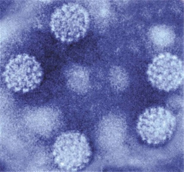 Großbritannien: HPV-Impfprogramm läuft weiter Humane Papillomaviren im Elektronenmikroskop.
